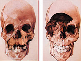 Atapuerca Skull, the